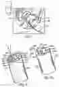 Fig. 02 - Non-Occlusive, Laterally-Constrained Injection Device