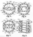 Fig. 03 - Non-Occlusive, Laterally-Constrained Injection Device