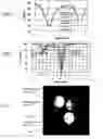 Fig. 02 - Method for enhancing contrast produced by MRI