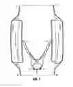 Fig. 08 - Apparatus for mechanically ventilating a patient