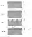 Fig. 02 - Wound dressing with controllable permeability