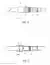 Fig. 07 - METHOD FOR CONNECTING IMPLANTED CONDUITS