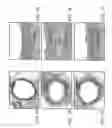Fig. 02 - Methods of treating vascular disease