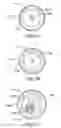 Fig. 07 - Electrosurgical apparatus having a temperature sensor
