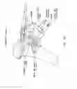 Fig. 49 - Method and apparatus for performing an open wedge, high tibial osteotomy