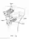 Fig. 85 - Method and apparatus for performing an open wedge, high tibial osteotomy