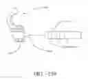 Fig. 102 - SPINE DISTRACTION IMPLANT AND METHOD