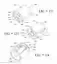 Fig. 119 - SPINE DISTRACTION IMPLANT AND METHOD