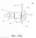 Fig. 126 - SPINE DISTRACTION IMPLANT AND METHOD