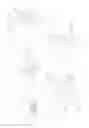 Fig. 18 - SPINE DISTRACTION IMPLANT AND METHOD