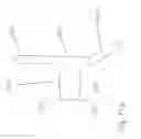 Fig. 33 - SPINE DISTRACTION IMPLANT AND METHOD