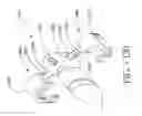 Fig. 75 - SPINE DISTRACTION IMPLANT AND METHOD