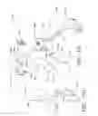 Fig. 76 - SPINE DISTRACTION IMPLANT AND METHOD