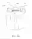 Fig. 82 - SPINE DISTRACTION IMPLANT AND METHOD
