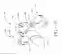 Fig. 83 - SPINE DISTRACTION IMPLANT AND METHOD