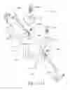 Fig. 95 - SPINE DISTRACTION IMPLANT AND METHOD