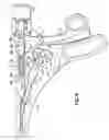 Fig. 06 - Endoscopic Threaded Clip