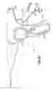 Fig. 33 - Endoscopic Threaded Clip