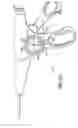 Fig. 35 - Endoscopic Threaded Clip