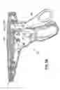 Fig. 40 - Endoscopic Threaded Clip