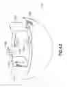 Fig. 45 - Endoscopic Threaded Clip