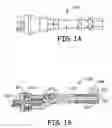 Fig. 02 - Vessel tensioning handle and method of vessel harvesting