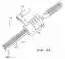 Fig. 09 - Vessel tensioning handle and method of vessel harvesting