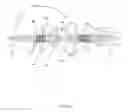 Fig. 02 - Mechanical embolectomy and suction catheter