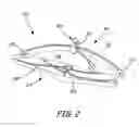 Fig. 04 - Bioabsorbable occlusion device