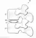 Fig. 01 - Non-Rigid Intervertebral Spacers