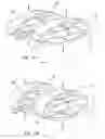 Fig. 07 - Non-Rigid Intervertebral Spacers