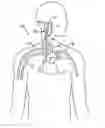 Fig. 01 - METHOD AND APPARATUS FOR SYNCHRONIZING NEURAL STIMULATION TO CARDIAC CYCLES
