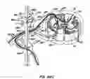 Fig. 28 - Neurostimulation system