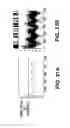 Fig. 41 - Neurostimulation system
