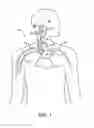 Fig. 02 - Method and Apparatus for Providing Complex Tissue Stimulation Parameters