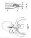 Fig. 09 - Method and Apparatus for Providing Complex Tissue Stimulation Parameters