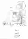 Fig. 02 - SPG stimulation for treating complications of subarachnoid hemorrhage