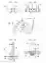 Fig. 06 - SPG stimulation for treating complications of subarachnoid hemorrhage