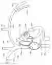 Fig. 02 - Intravascular implantable device having superior anchoring arrangement