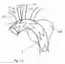 Fig. 07 - Stent prosthesis for vascular surgery in particular in the area of the aortic arch