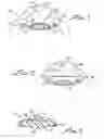 Fig. 02 - PRIMARY AND SUPPLEMENTAL INTRAOCULAR LENS SYSTEM