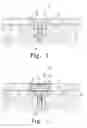 Fig. 02 - CARTILAGE REPAIR APPARATUS AND METHOD