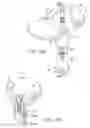 Fig. 22 - Knee joint prosthesis system and method for implantation
