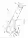 Fig. 02 - PROSTHETIC HIP IMPLANTS