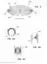 Fig. 06 - Stent for maintaining patency of a body region