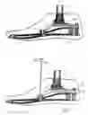 Fig. 02 - Adjustable orthopedic aid for an extremity