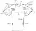 Fig. 01 - Hospital Gown