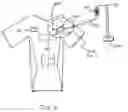 Fig. 03 - Hospital Gown