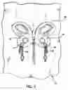 Fig. 04 - DECORATIVE PATCH JEWELRY RETAINER