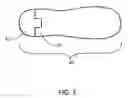 Fig. 07 - Progressive Compression Attachment for Shoes